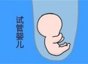 培养台州捐卵宝宝艺术细胞的小技巧